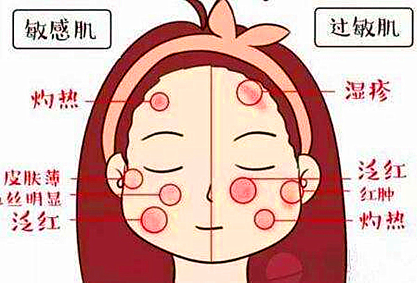 敏感性皮膚與過敏肌膚、