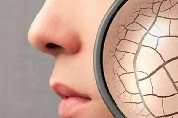 皮膚衰老的原因之內因與外因