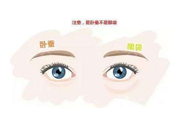 臥蠶和眼袋的區別