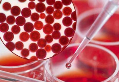 蝦青素涂臉后色素沉著怎么辦