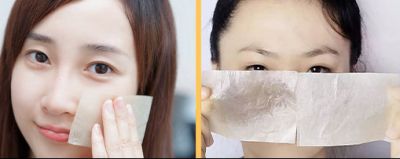 1445494111311 鼻子出油毛孔粗大是什么原因