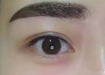 1650502611311 紋完眉多久可以恢復自然