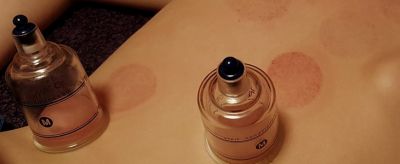 1727213511310 拔罐減肥有效嗎