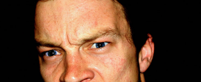 2320535311310 臉上出油是什么原因