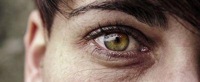 下眼袋浮腫怎么辦