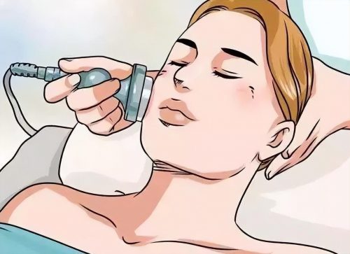 如何快速去除傷疤