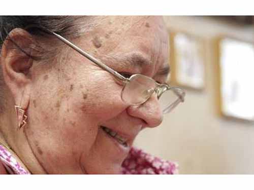 祛老年斑最有效的辦法