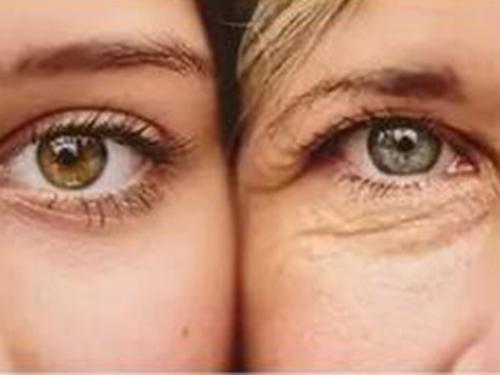 如何除皺紋效果好