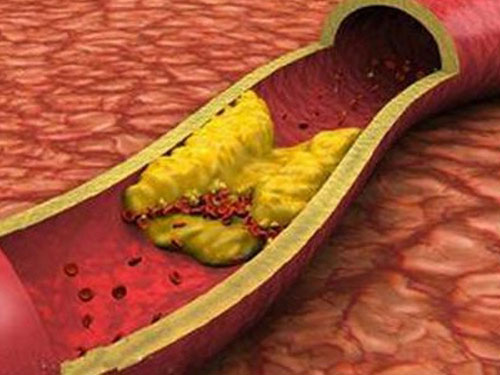 怎樣排除體內毒素