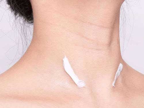 8_201993153809764_4 頸部除皺最好的辦法