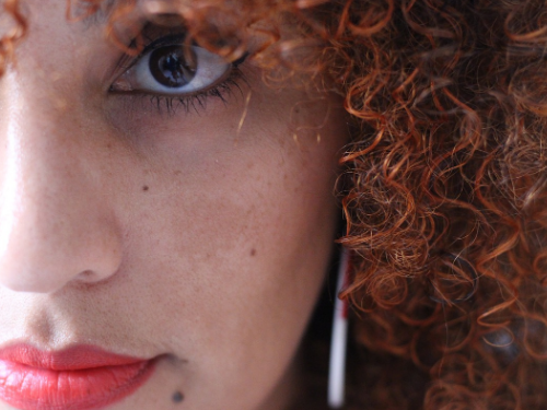 顴骨長斑是什么原因